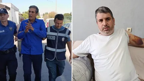 Dayısının saldırısına uğrayan Alpaltun, 