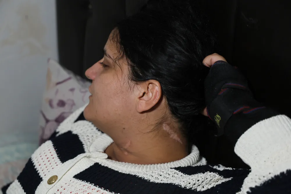 Adana’da Eş Dehşeti! Boğazını Kesti, Engelli Bıraktı.