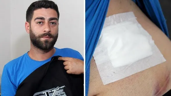 Ağrı Var Diye Hastaneye Gitti... Vücudun
