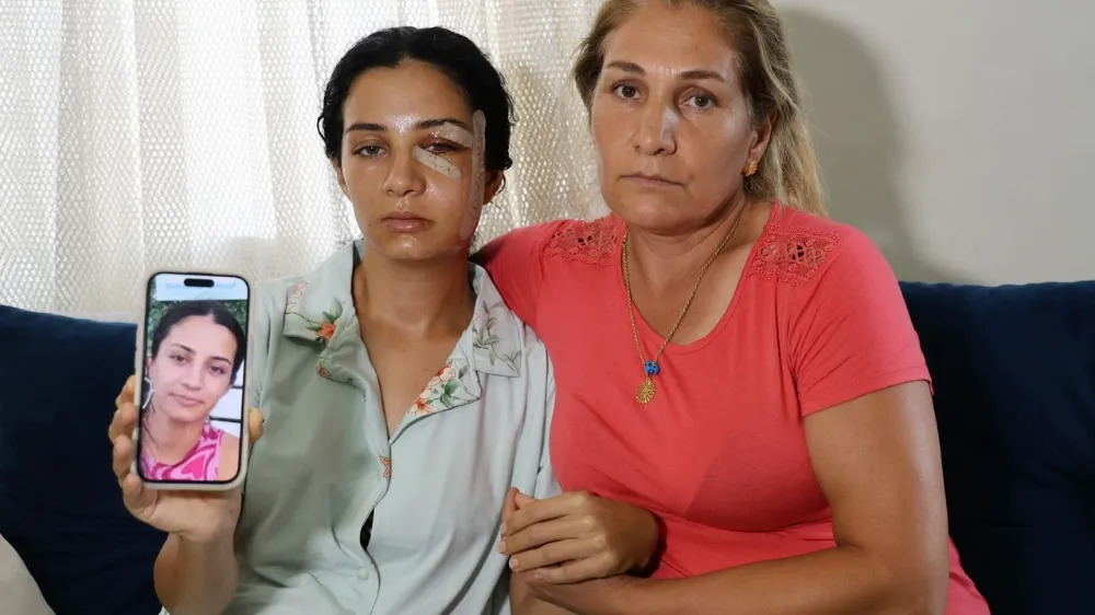 Adana’da Eski Eş Dehşeti...Yüzüne Platin Takıldı.