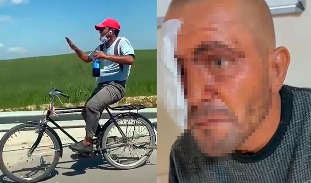 Adana'da Sosyal medya fenomeni olan zihinsel engelli şahıs darbedildi.