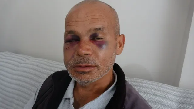 Adana'da Engelli adamı darbeden şüpheli serbest bırakıldı